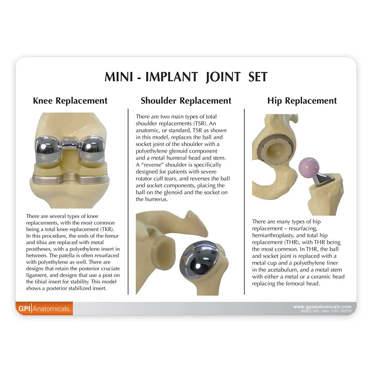 Mini Implant Joint Set