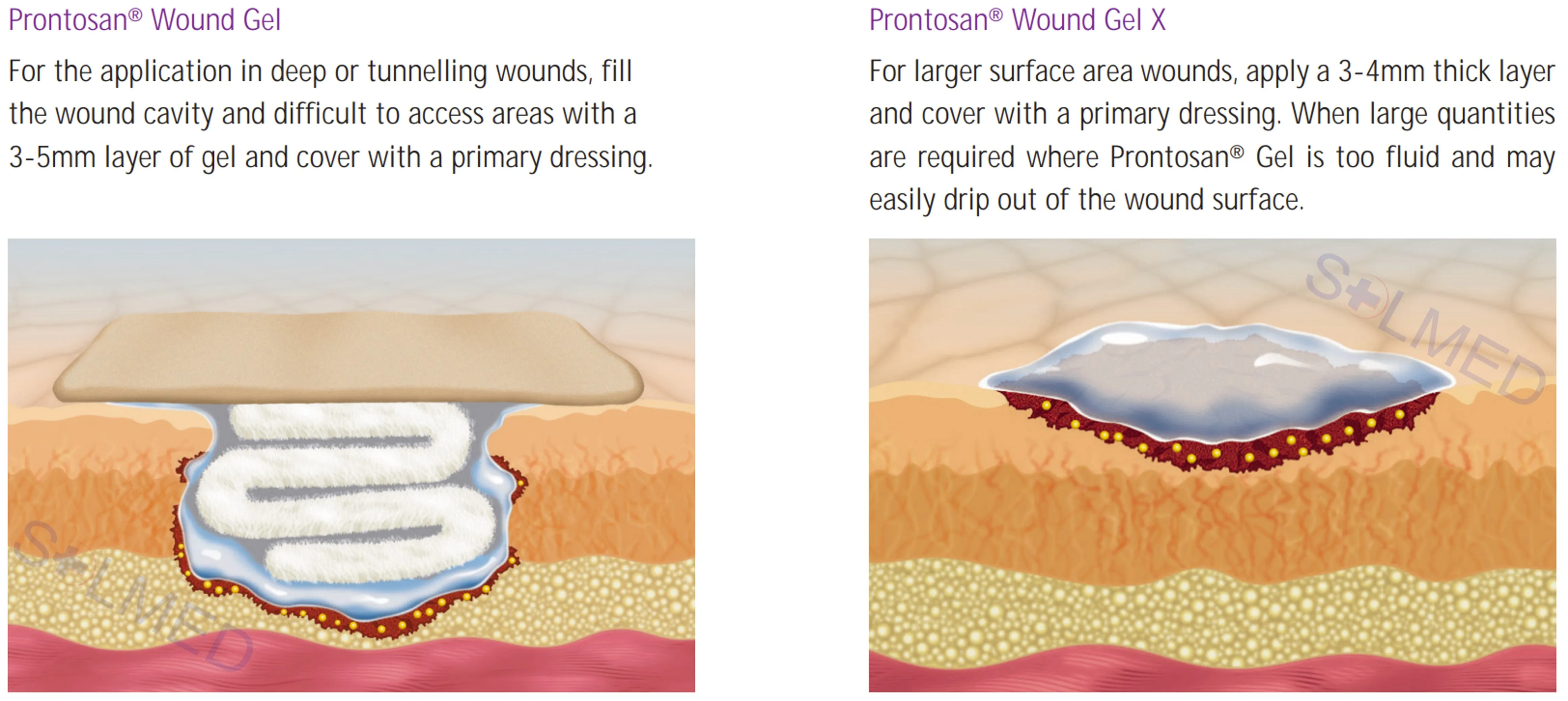 Prontosan Wound Gel X
