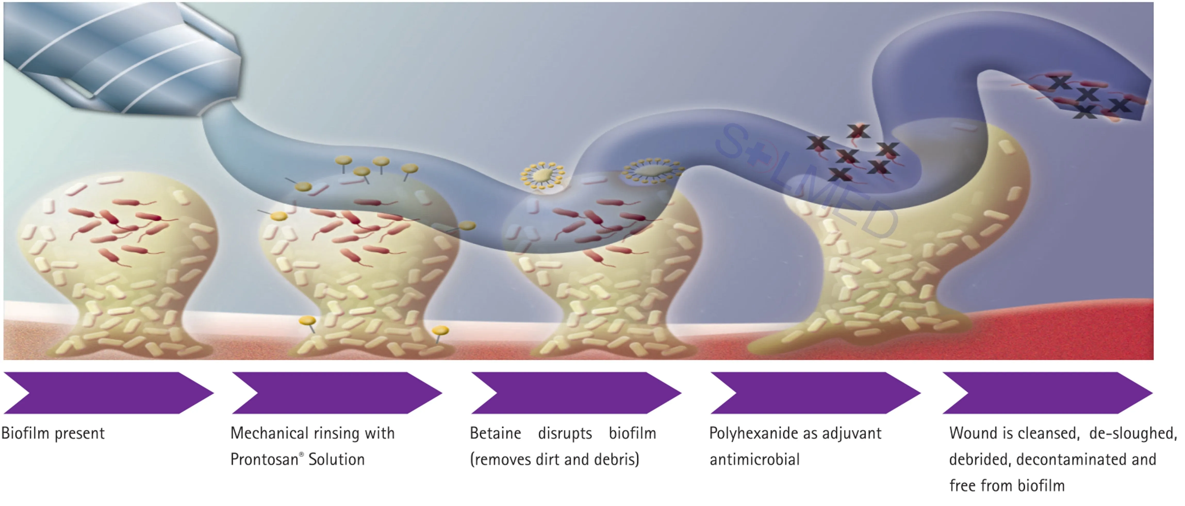 Prontosan Wound Solution